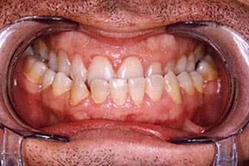 Imagen clínica de Ortodoncia