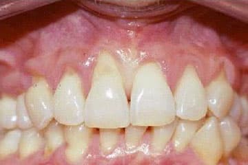 Imagen clínica de Periodoncia